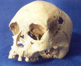 skull